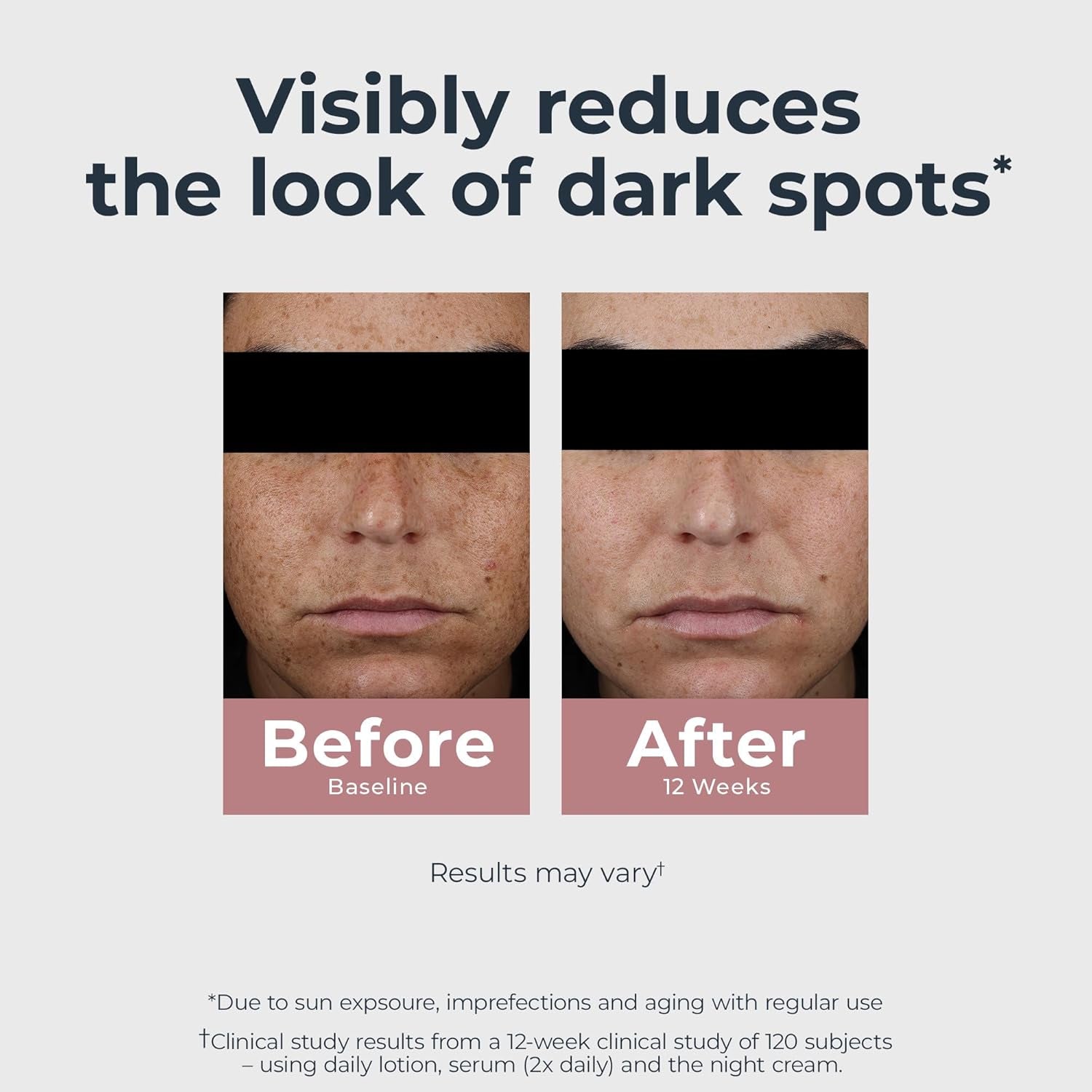 Radiant Tone Night Cream, Dark Spot Corrector with Thiamidol, Night Moisturizer for Face Helps Visibly Reduce the Look of Persistent Dark Spots, All Skin Types, 1.7 Oz Bottle