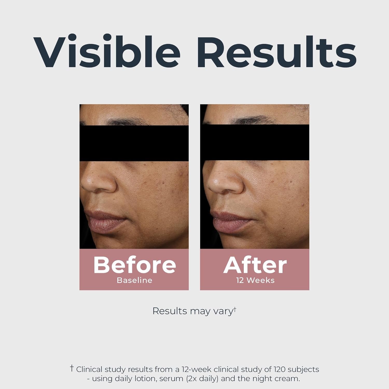 Radiant Tone Night Cream, Dark Spot Corrector with Thiamidol, Night Moisturizer for Face Helps Visibly Reduce the Look of Persistent Dark Spots, All Skin Types, 1.7 Oz Bottle